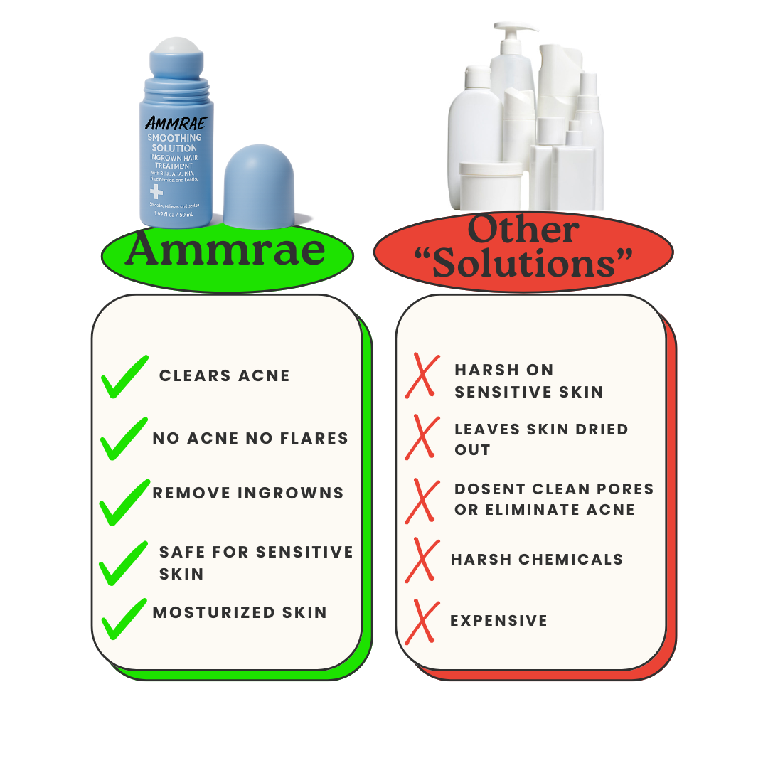 Soothing Removal Roller